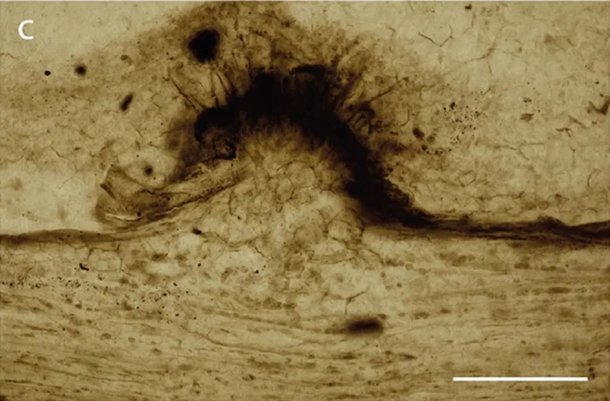 Imagem mostra momento em que planta tentou criar uma barreira para impedir avano do fungo. (Fonte: Live Science/Reproduo)