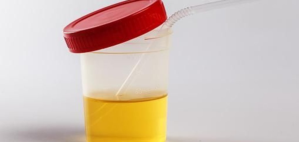 tiktoker-recomenda-usar-urina-para-curar-a-visao-o-que-a-ciencia-diz-disso-thumb.png