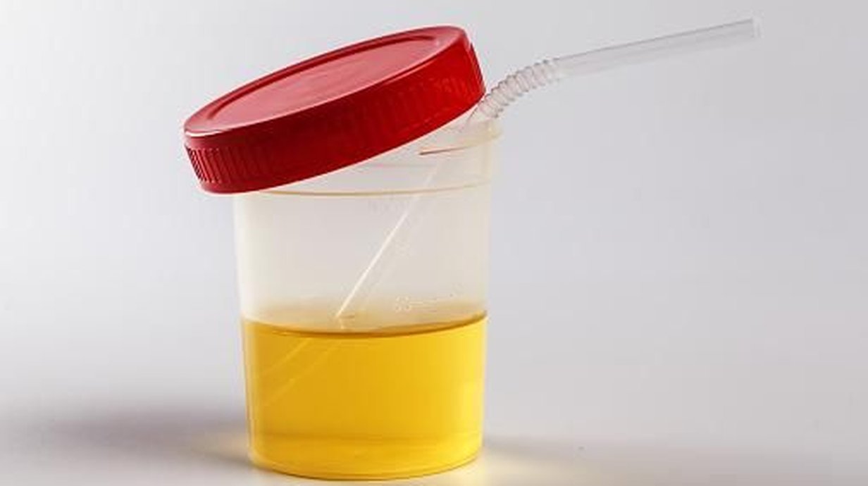 tiktoker-recomenda-usar-urina-para-curar-a-visao-o-que-a-ciencia-diz-disso-thumb.png