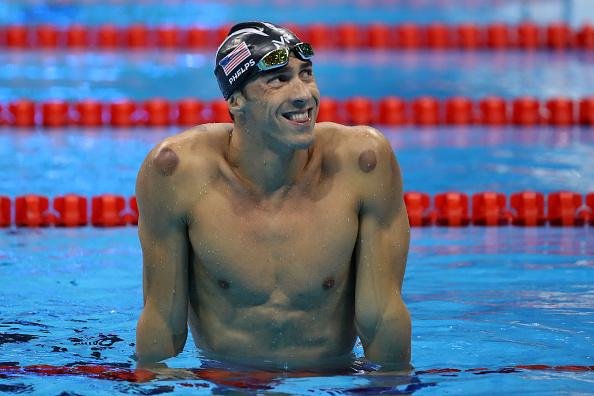 Em edições passadas das Olimpíadas, Michael Phelps também apareceu com sinais de ventosaterapia. (Fonte: Getty Images)