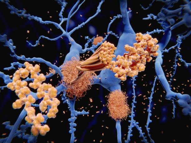 A proteína beta-amiloide se manifesta tanto na proteção quanto no ataque do cérebro. (Fonte: GettyImages/ Reprodução) 