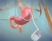 thumb-image-2024-02-29T13:59:47.415Z
