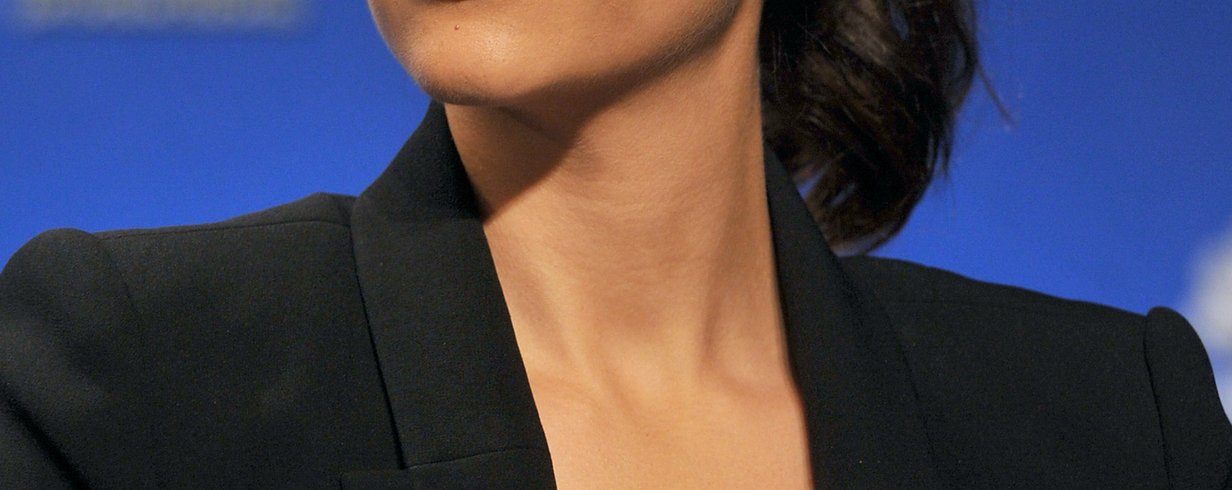 thumb-image-2024-02-29T14:00:13.157Z